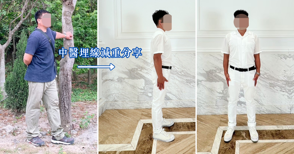 【台南中醫減肥推薦】健恩中醫診所埋線減重+針灸減肥心得分享!