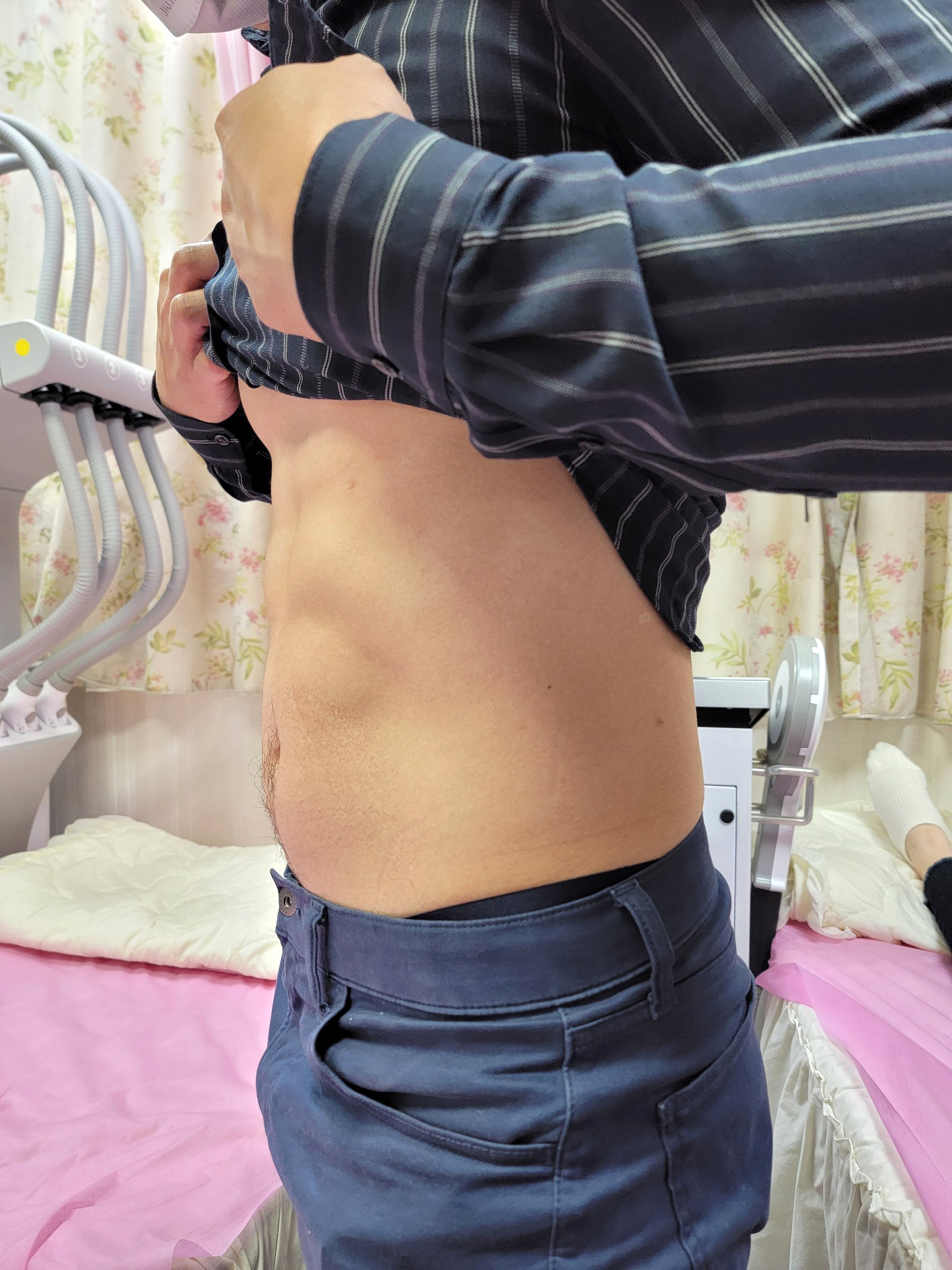 腹部線條的變化
