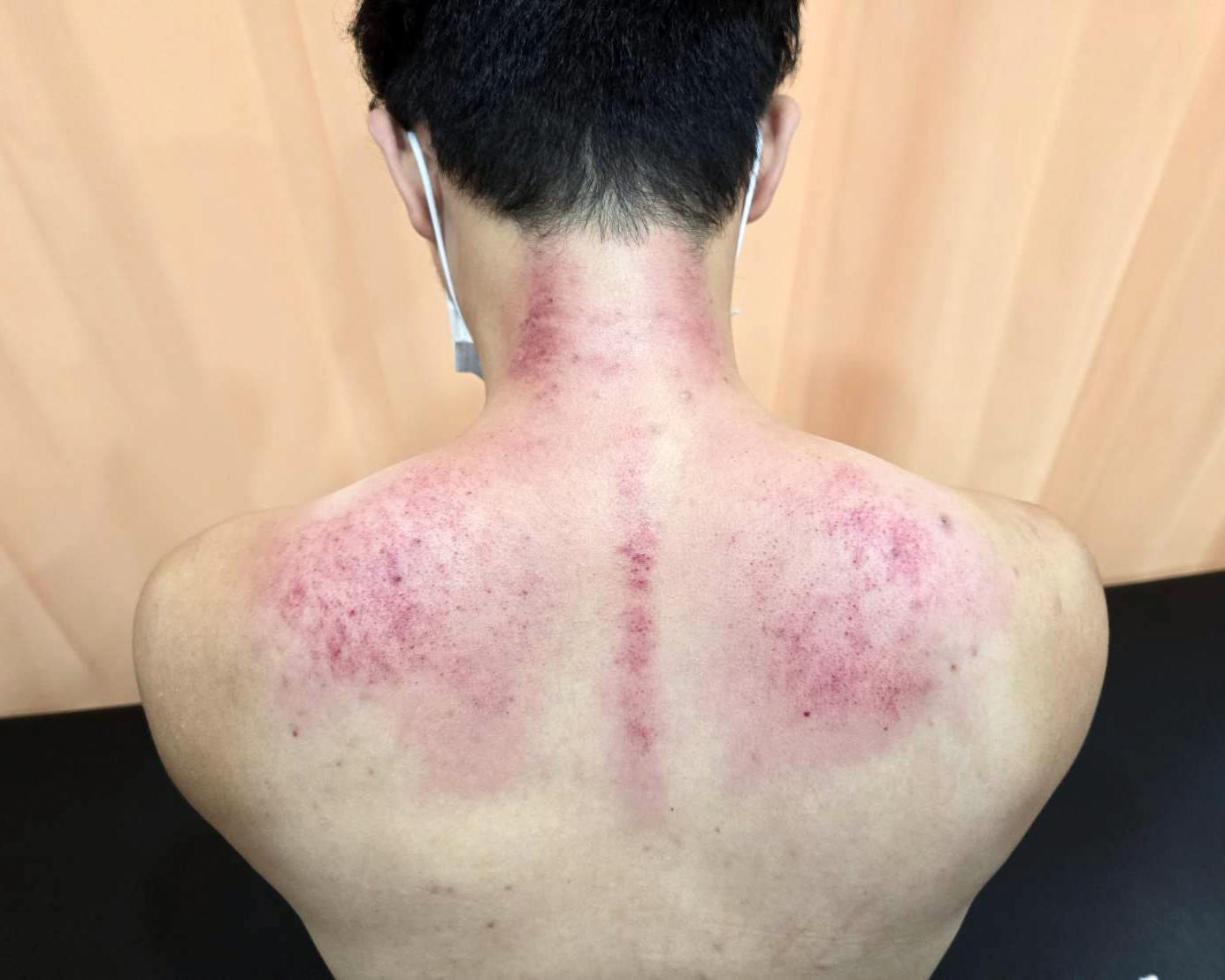 療程後的放鬆狀態