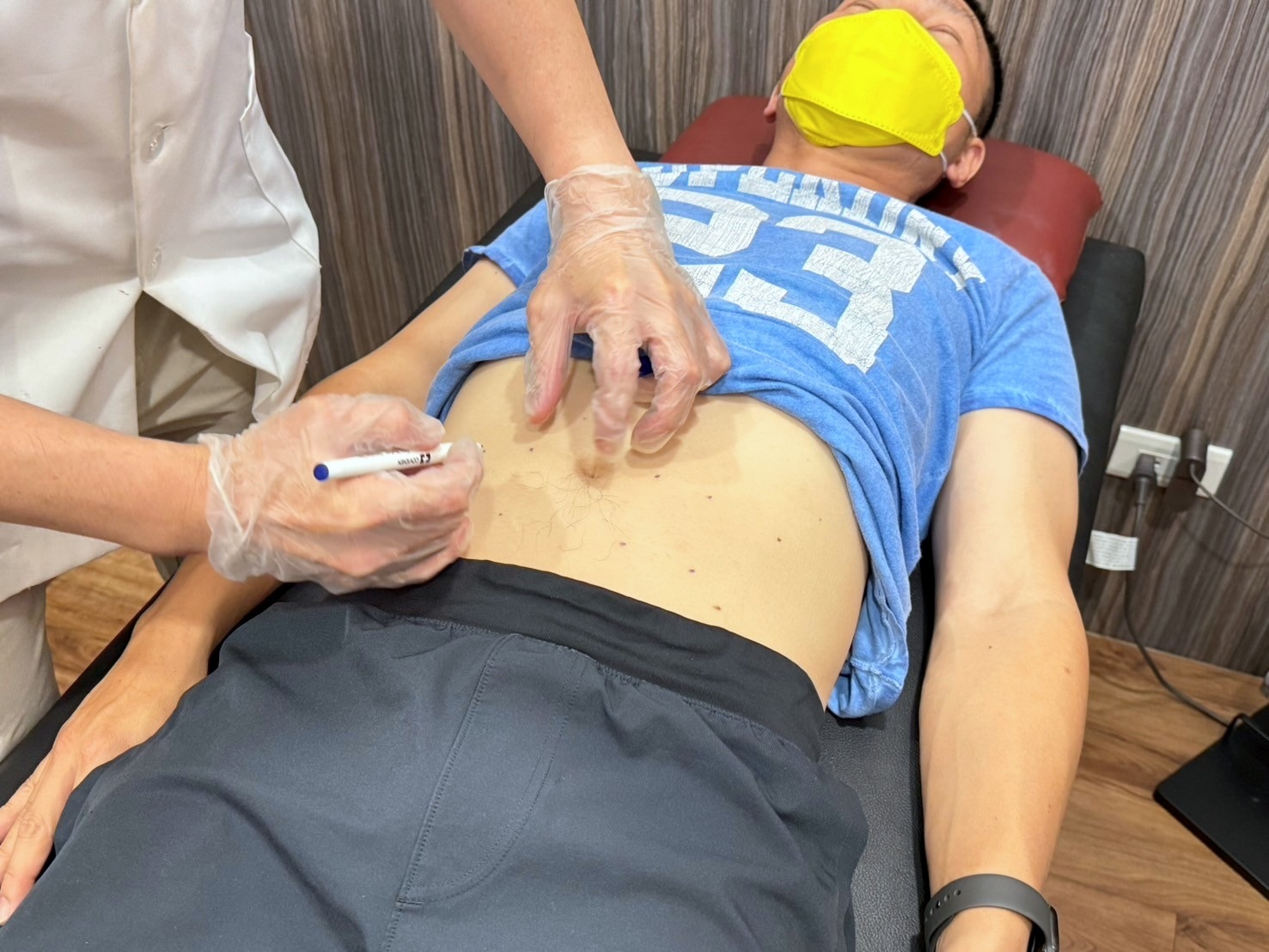 健恩中醫專業減肥埋線技術示範